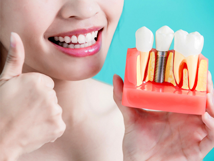 Implantologie et implant dentaire